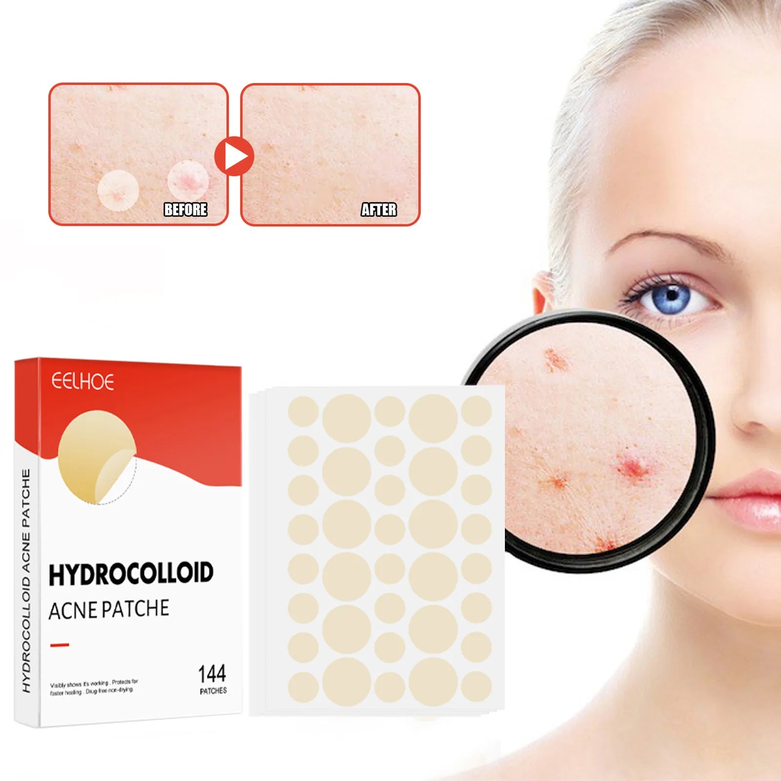 144pcs/set Face Skin Care Acne Pimple Patch 2 Sizes Invisible Professional